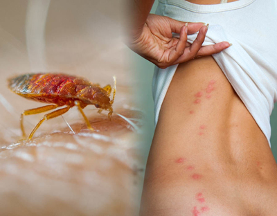Bed Bugs Control Service